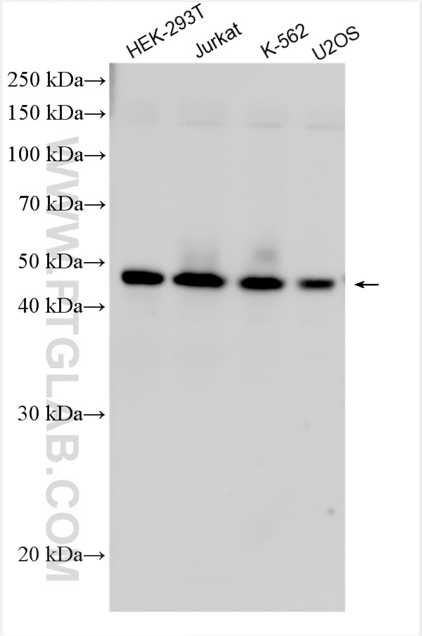 Western Blot (WB) analysis of various lysates using SNX5 Polyclonal antibody (17918-1-AP)