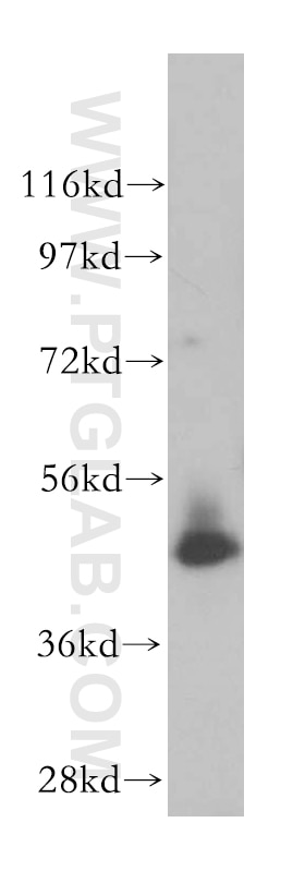 Western Blot (WB) analysis of human kidney tissue using SNX5 Polyclonal antibody (17918-1-AP)