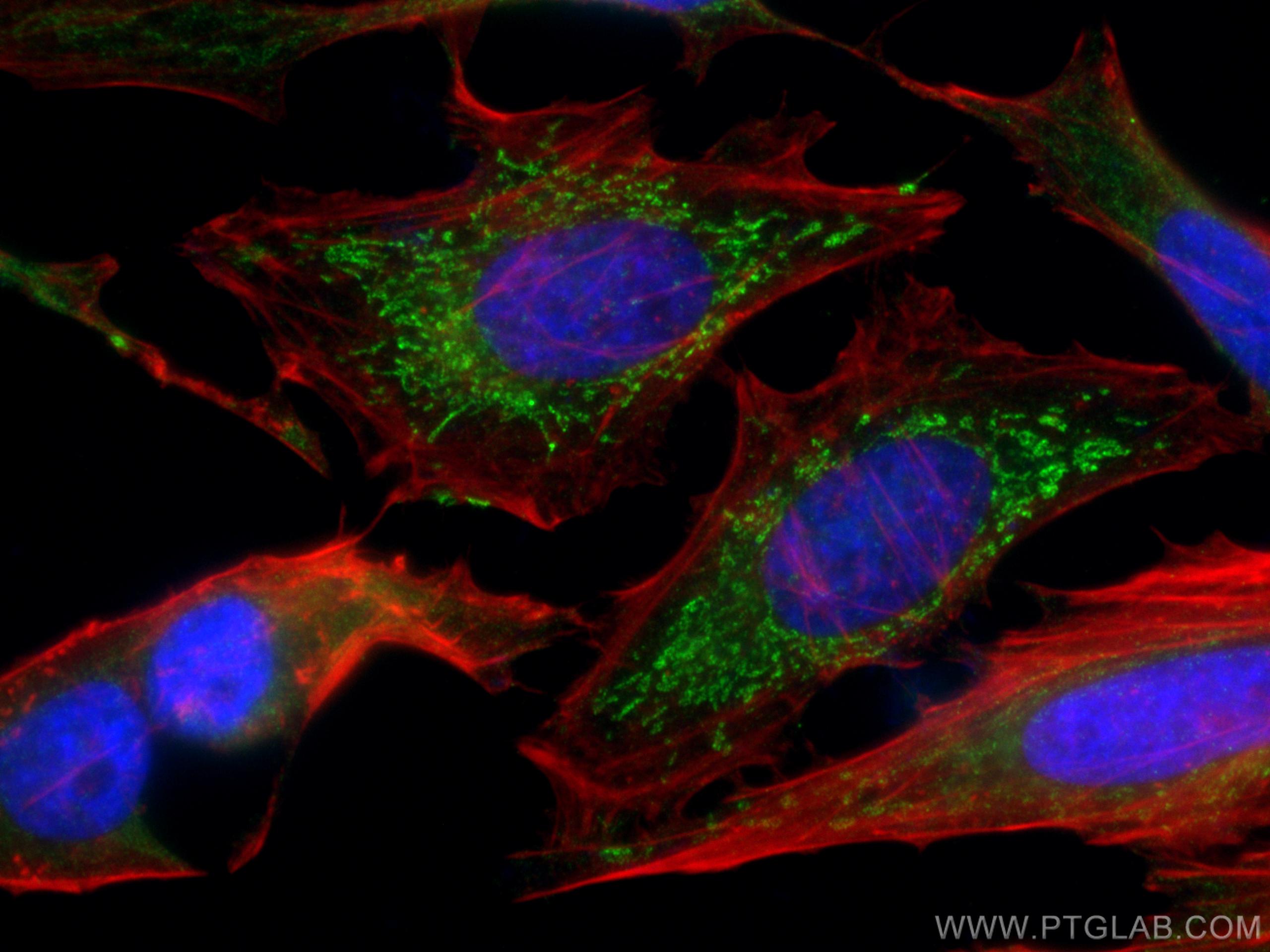 Immunofluorescence (IF) / fluorescent staining of HeLa cells using SNX5 Monoclonal antibody (67665-1-Ig)