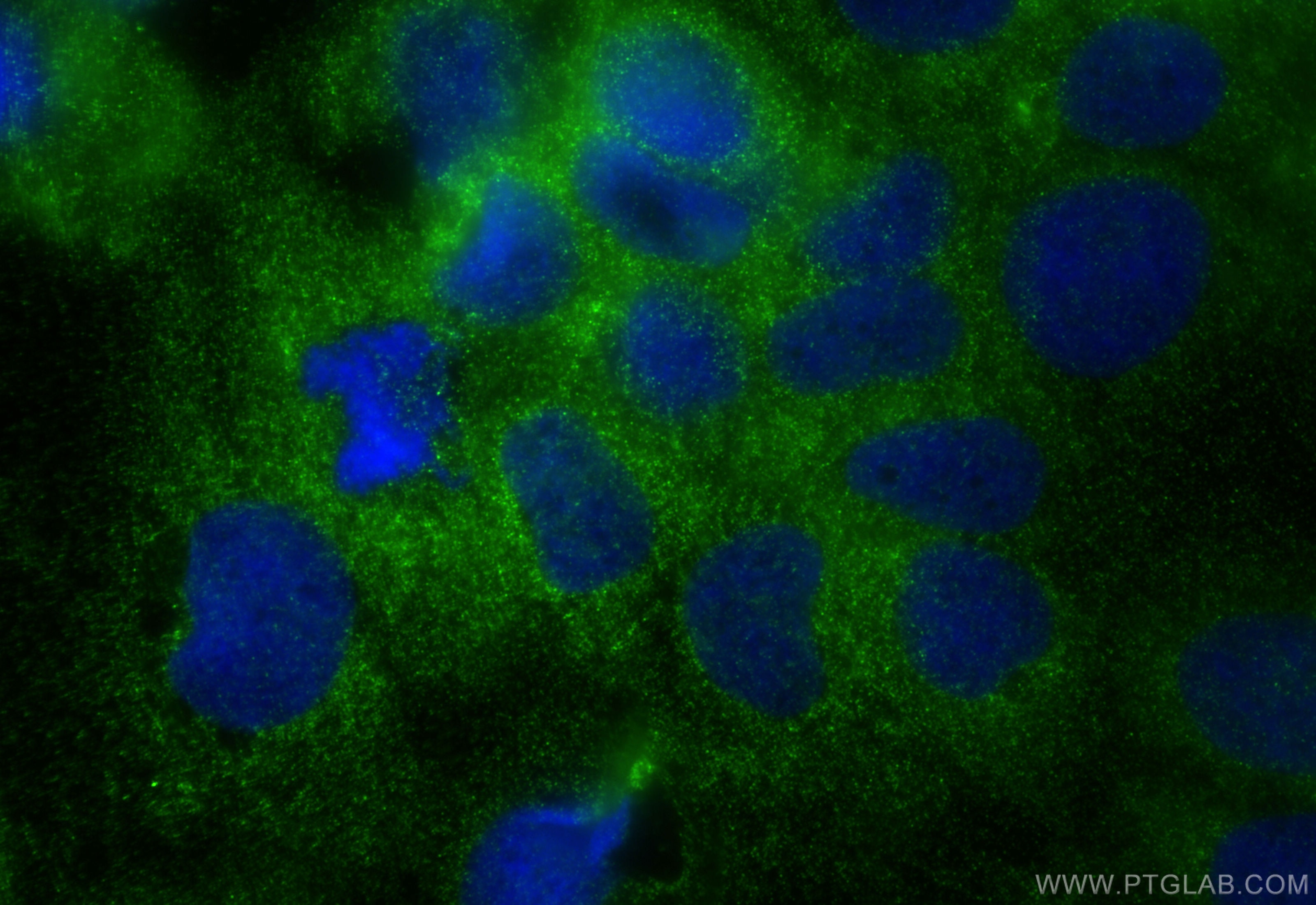 Immunofluorescence (IF) / fluorescent staining of Caco-2 cells using SNX5 Monoclonal antibody (67665-1-Ig)