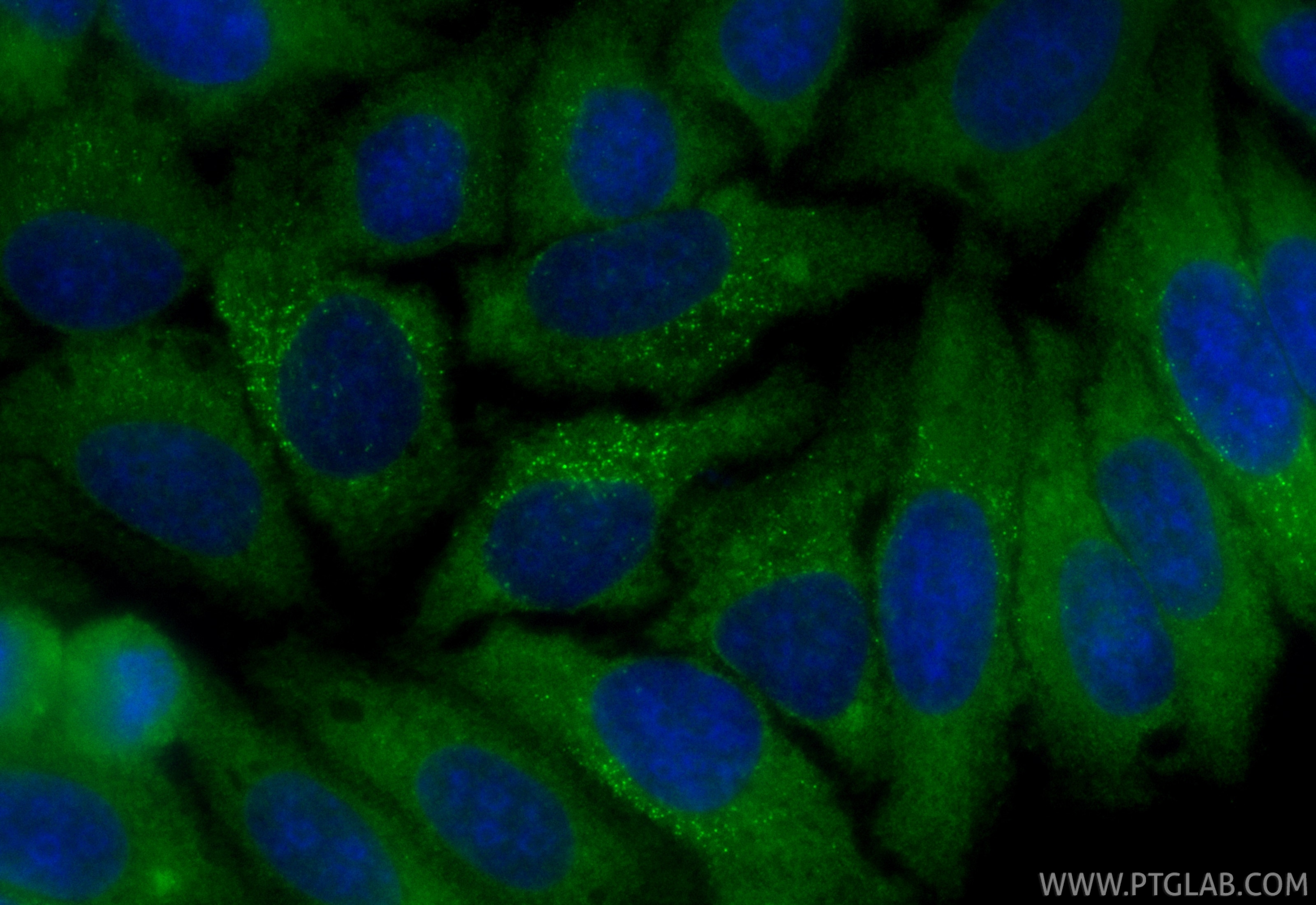 IF Staining of HepG2 using CL488-67665 Immunofluorescence (IF) / fluorescent staining of HepG2 cells using CoraLite® Plus 488-conjugated SNX5 Monoclonal anti (CL488-67665)