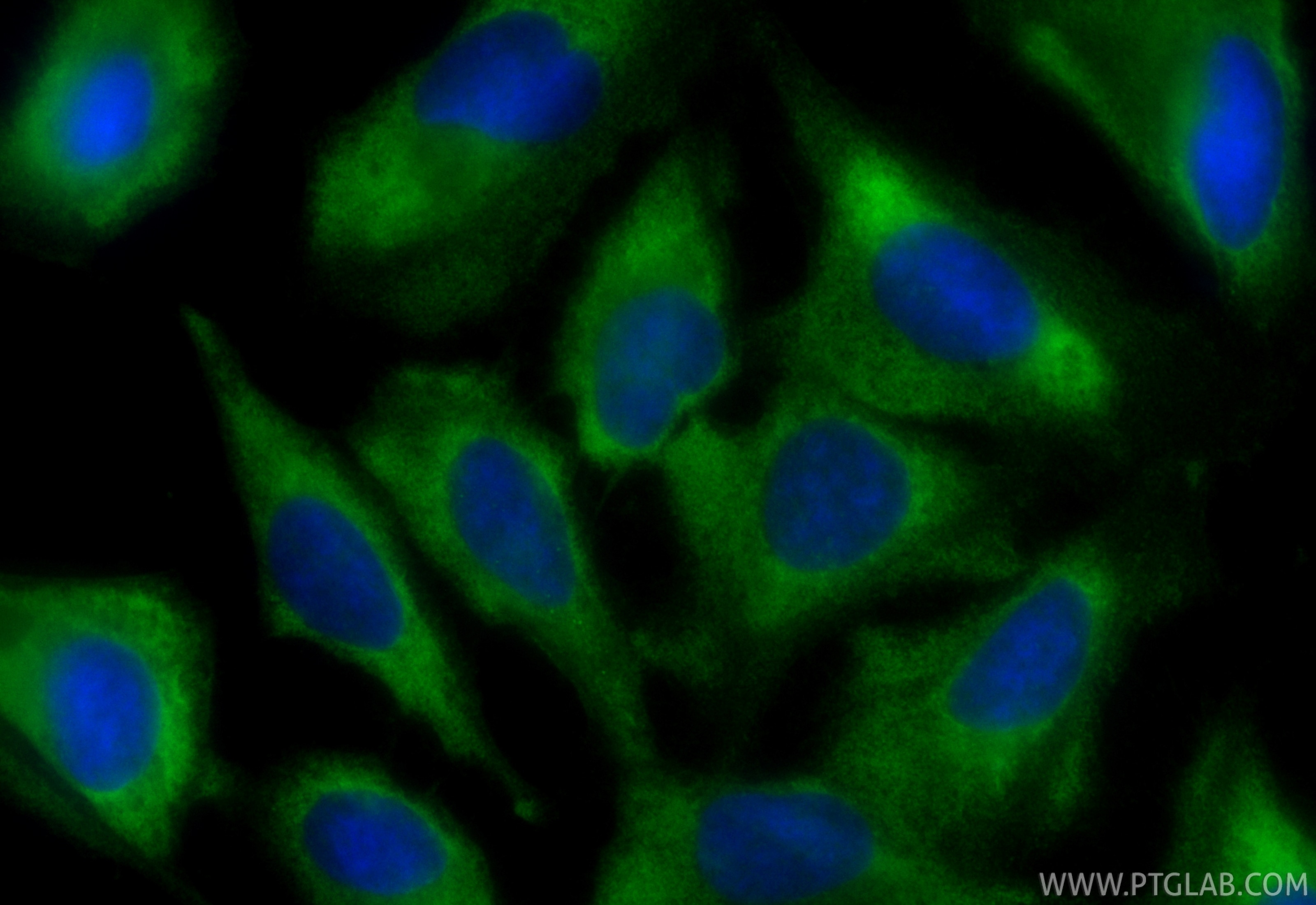 IF Staining of U2OS using CL488-67665 Immunofluorescence (IF) / fluorescent staining of U2OS cells using CoraLite® Plus 488-conjugated SNX5 Monoclonal anti (CL488-67665)
