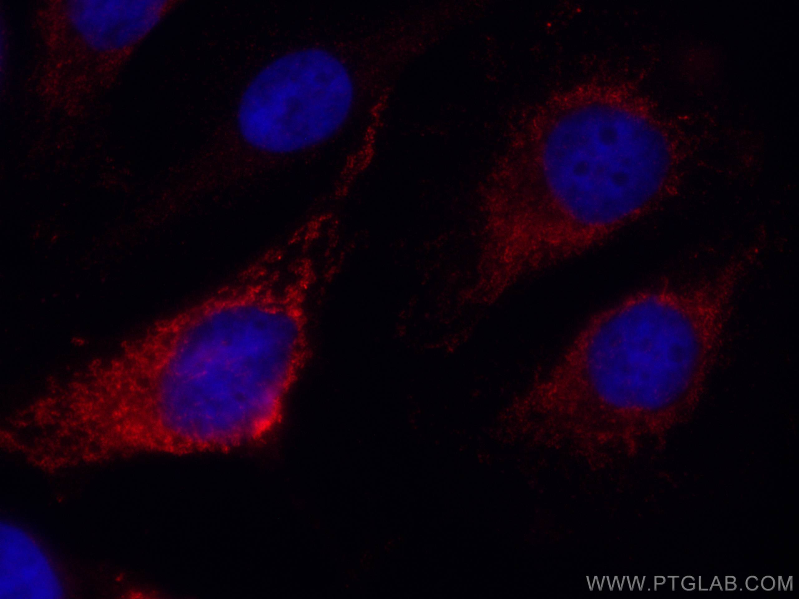 Immunofluorescence (IF) / fluorescent staining of HeLa cells using CoraLite®594-conjugated SNX5 Monoclonal antibody (CL594-67665)