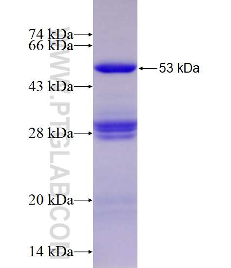 SNX5 fusion protein Ag12993 SDS-PAGE