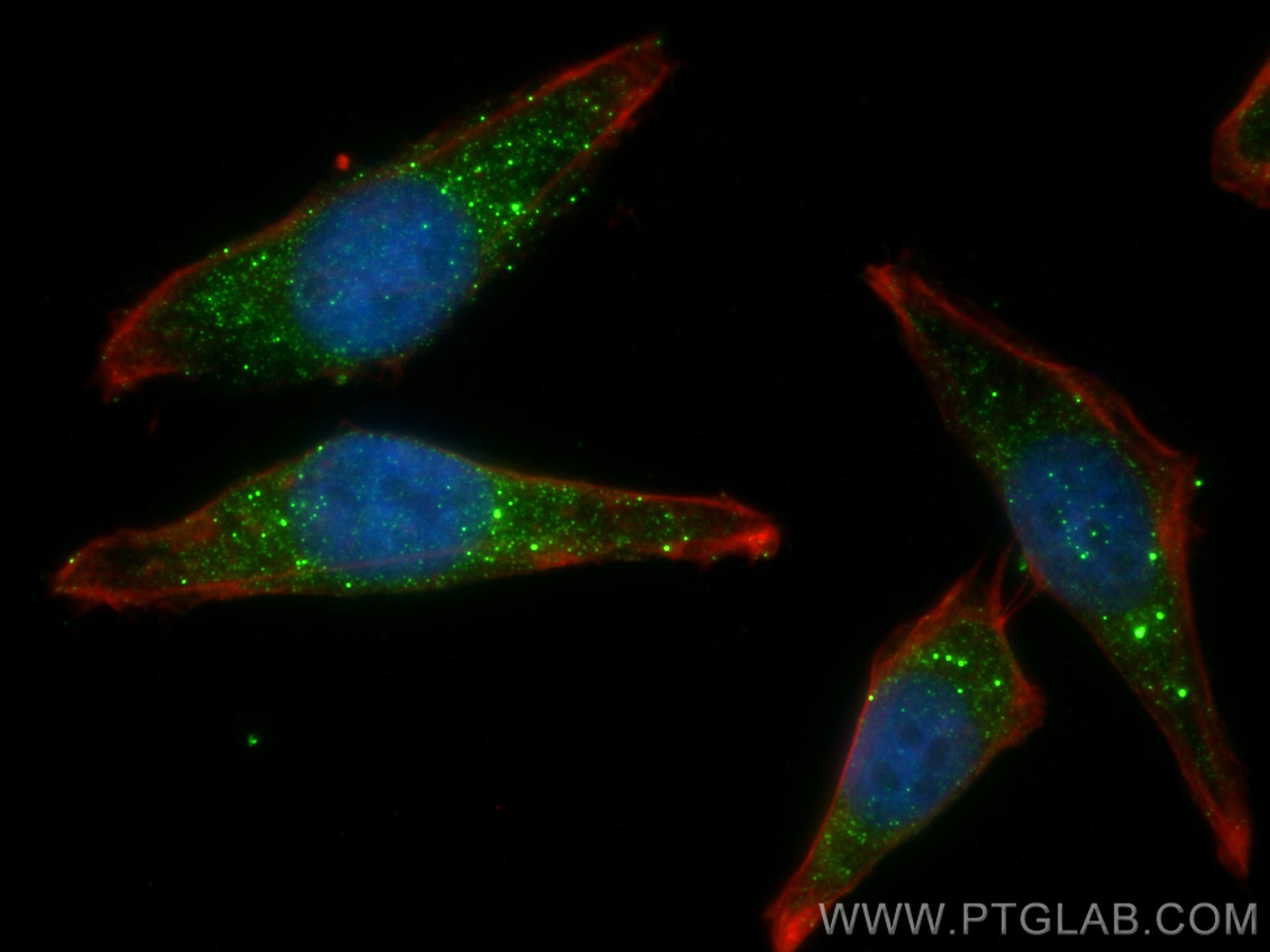 Immunofluorescence (IF) / fluorescent staining of HepG2 cells using SNX6 Polyclonal antibody (10114-1-AP)