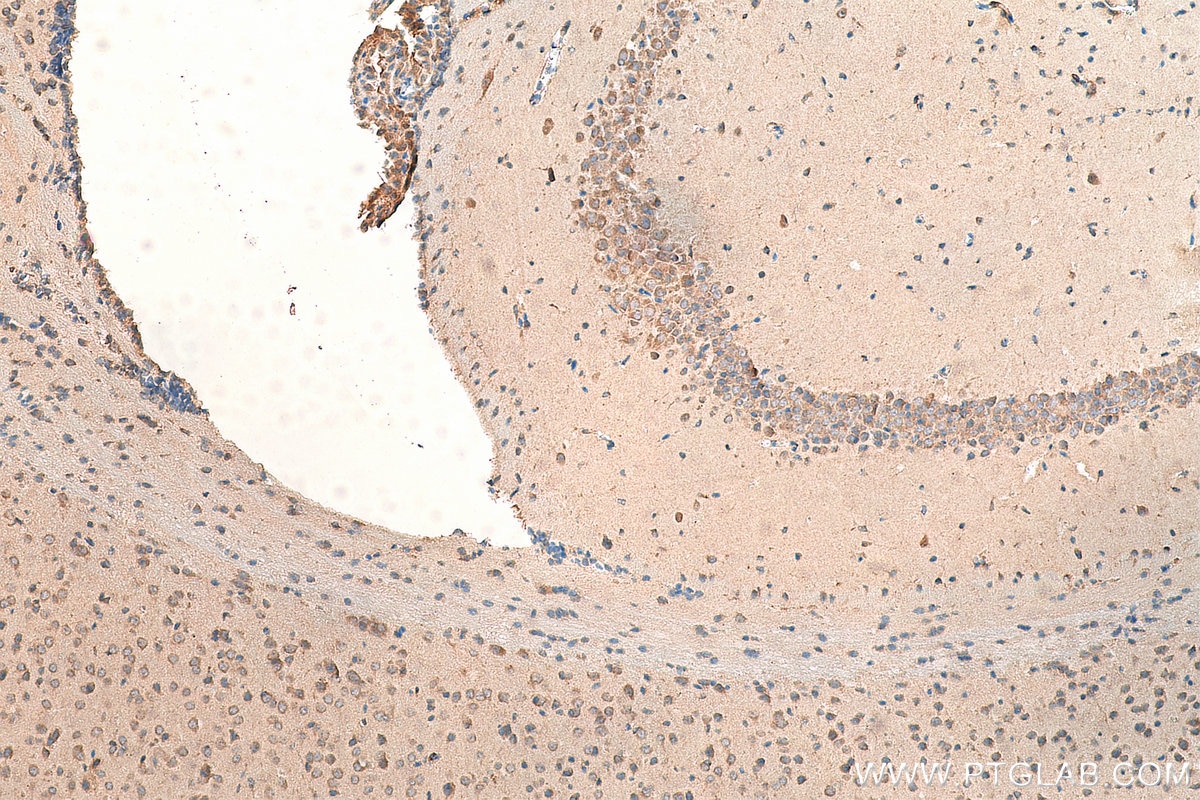 Immunohistochemistry (IHC) staining of mouse brain tissue using SNX6 Polyclonal antibody (10114-1-AP)