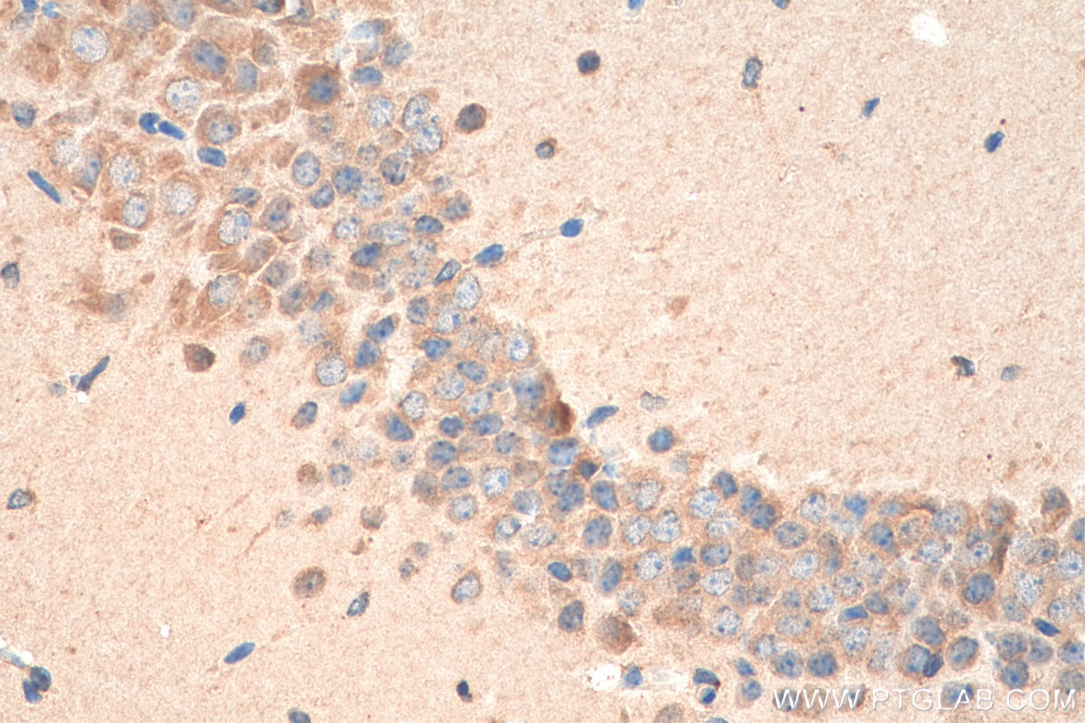 Immunohistochemistry (IHC) staining of mouse brain tissue using SNX6 Polyclonal antibody (10114-1-AP)