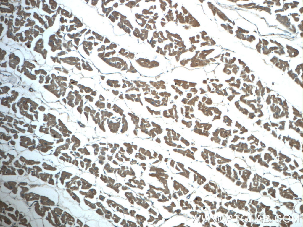 Immunohistochemistry (IHC) staining of human heart tissue using SNX6 Polyclonal antibody (10114-1-AP)