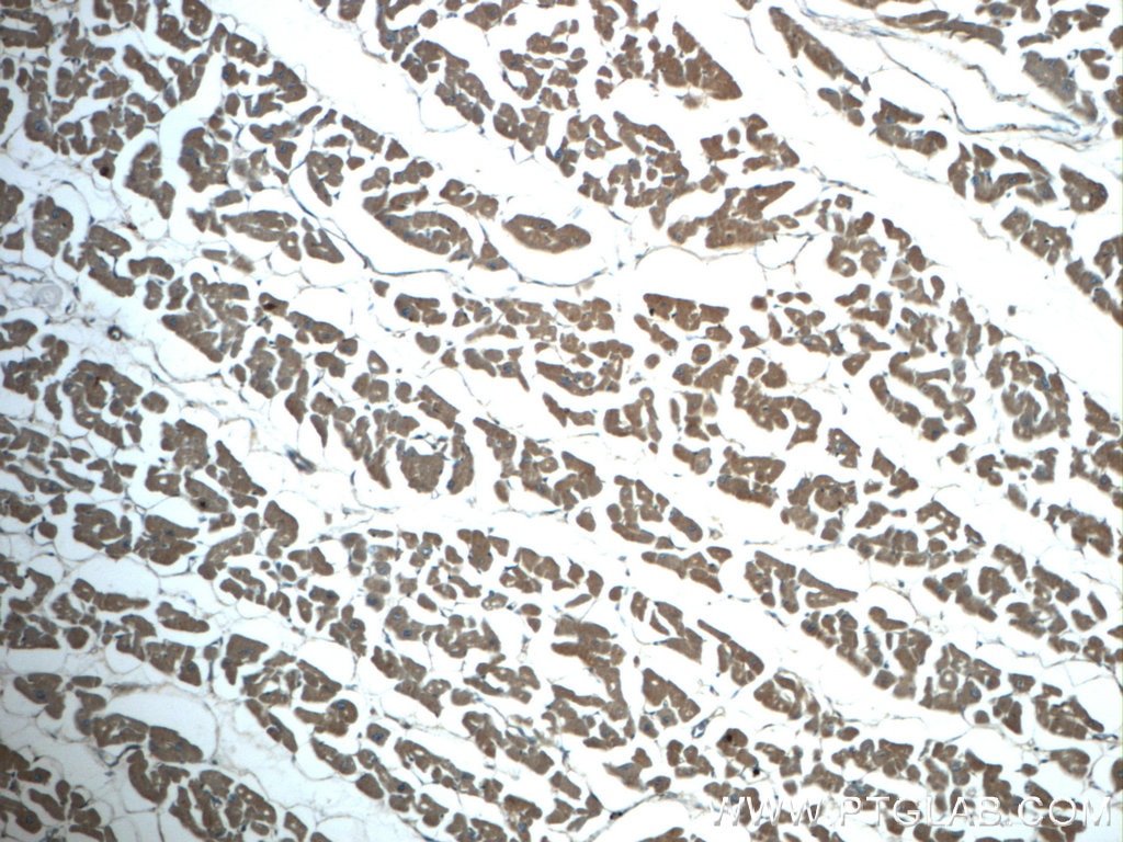 IHC staining of human heart using 10114-1-AP