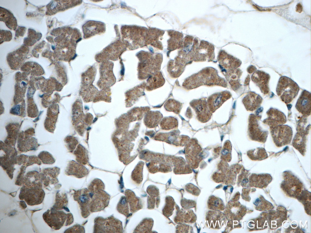 IHC staining of human heart using 10114-1-AP