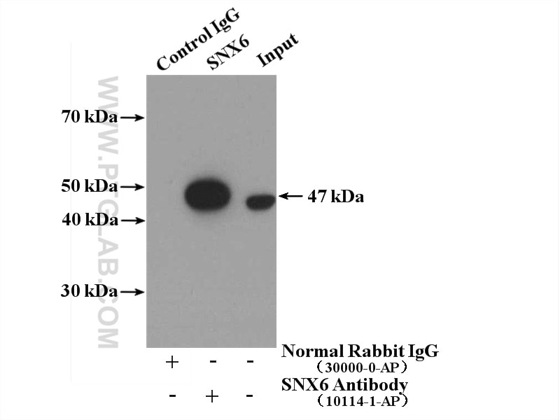 Immunoprecipitation (IP) experiment of HepG2 cells using SNX6 Polyclonal antibody (10114-1-AP)