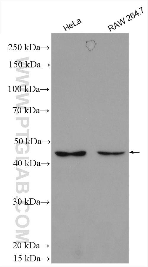 Western Blot (WB) analysis of various lysates using SNX6 Polyclonal antibody (10114-1-AP)