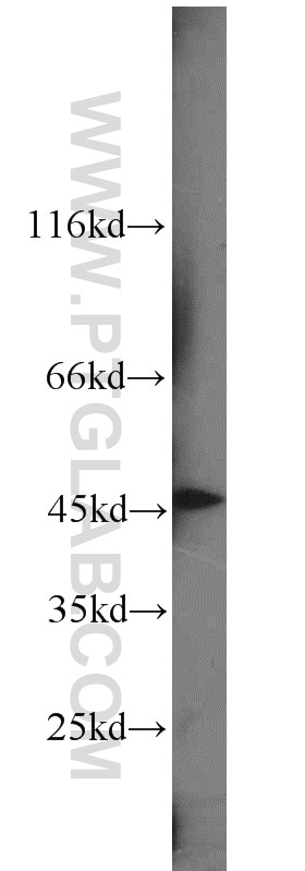 Western Blot (WB) analysis of human placenta tissue using SNX6 Polyclonal antibody (10114-1-AP)