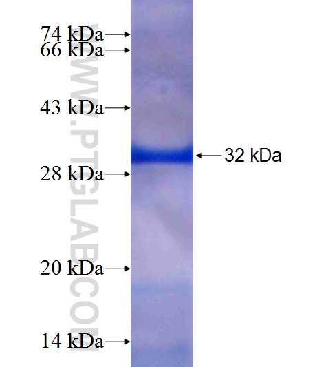 SNX6 fusion protein Ag20359 SDS-PAGE