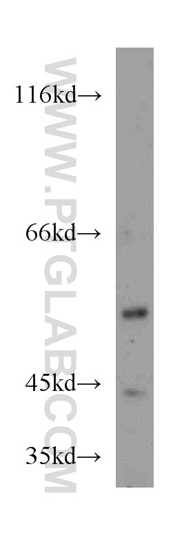Western Blot (WB) analysis of HeLa cells using SNX7 Polyclonal antibody (12269-1-AP)
