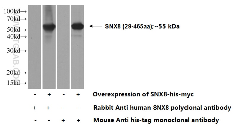 SNX8 Polyclonal antibody