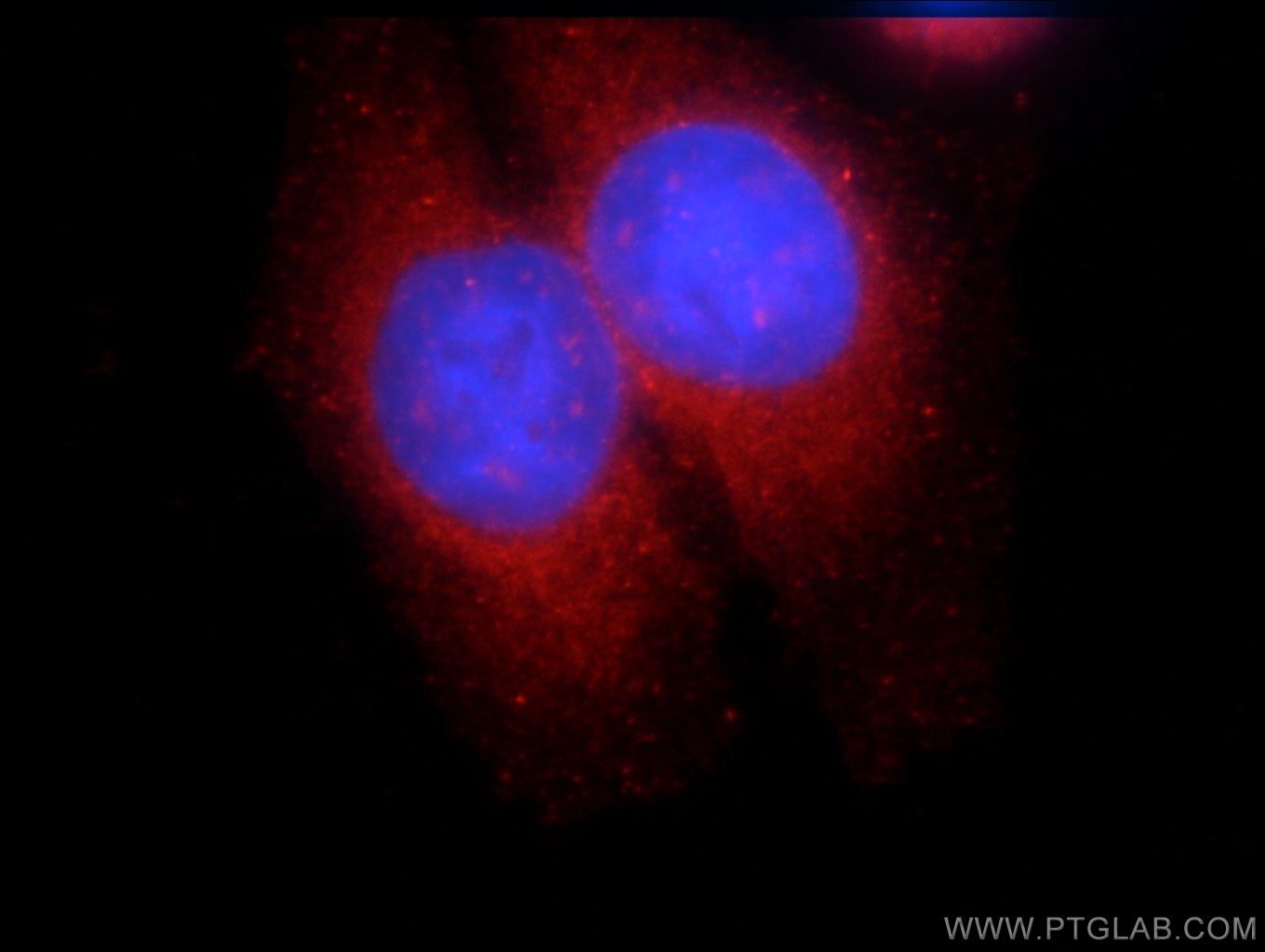 Immunofluorescence (IF) / fluorescent staining of HeLa cells using SNX9 Polyclonal antibody (15721-1-AP)