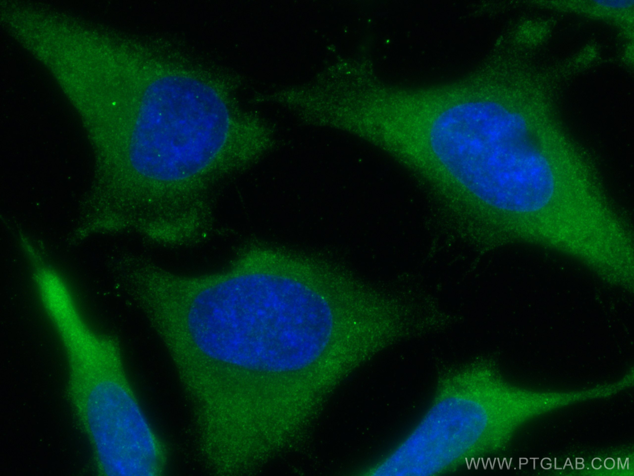 IF Staining of HeLa using 15721-1-AP