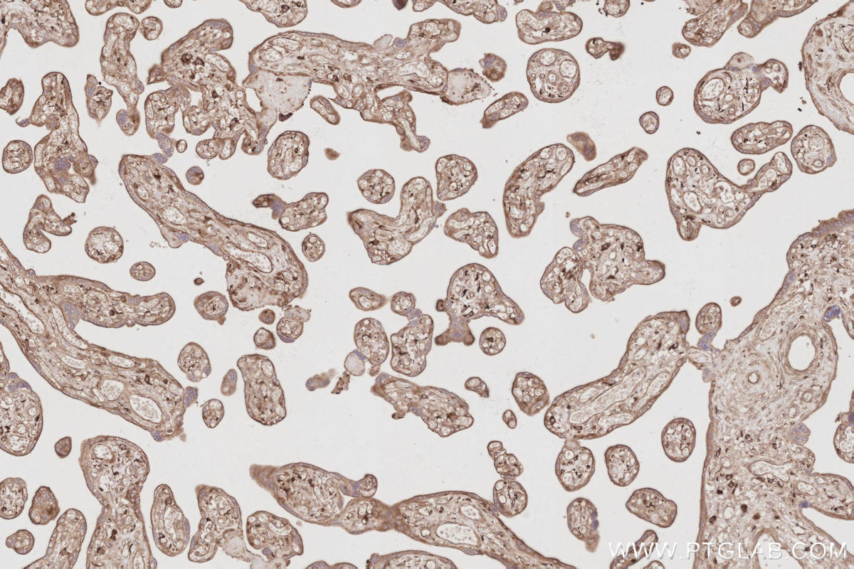 Immunohistochemistry (IHC) staining of human placenta tissue using SNX9 Polyclonal antibody (15721-1-AP)