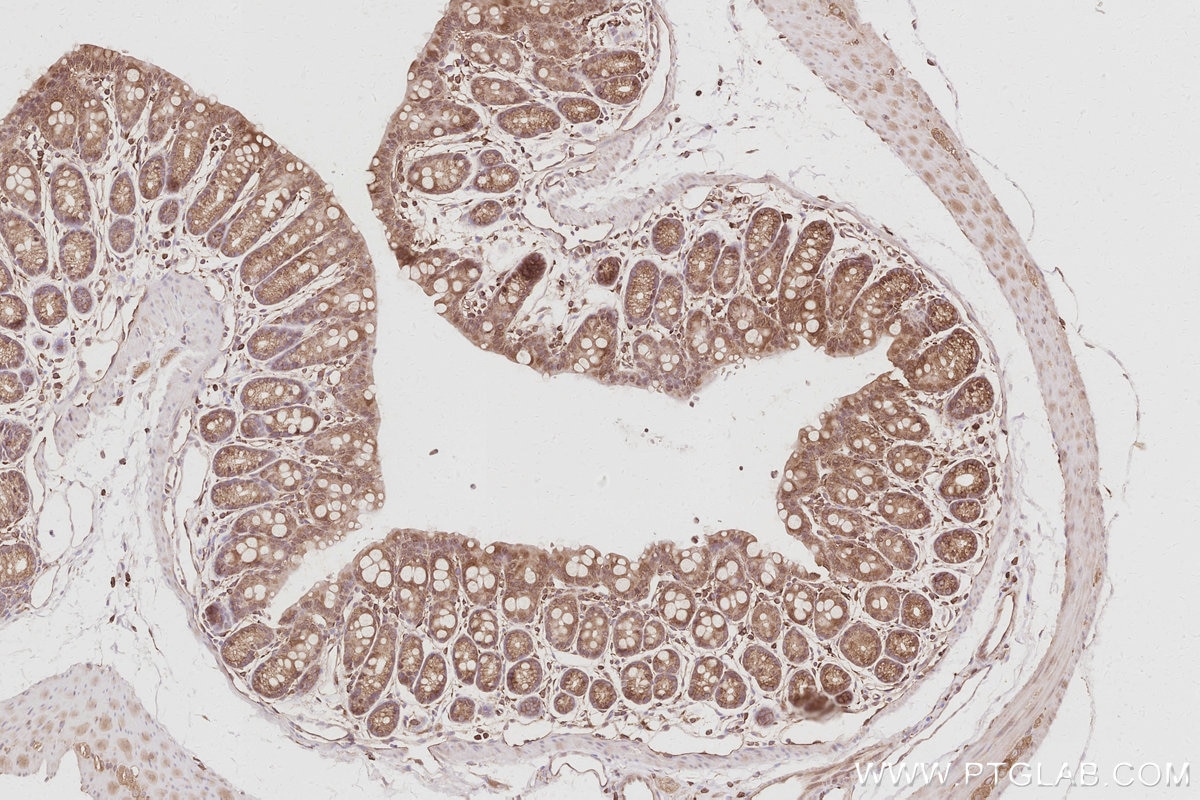 Immunohistochemistry (IHC) staining of mouse colon tissue using SNX9 Polyclonal antibody (15721-1-AP)