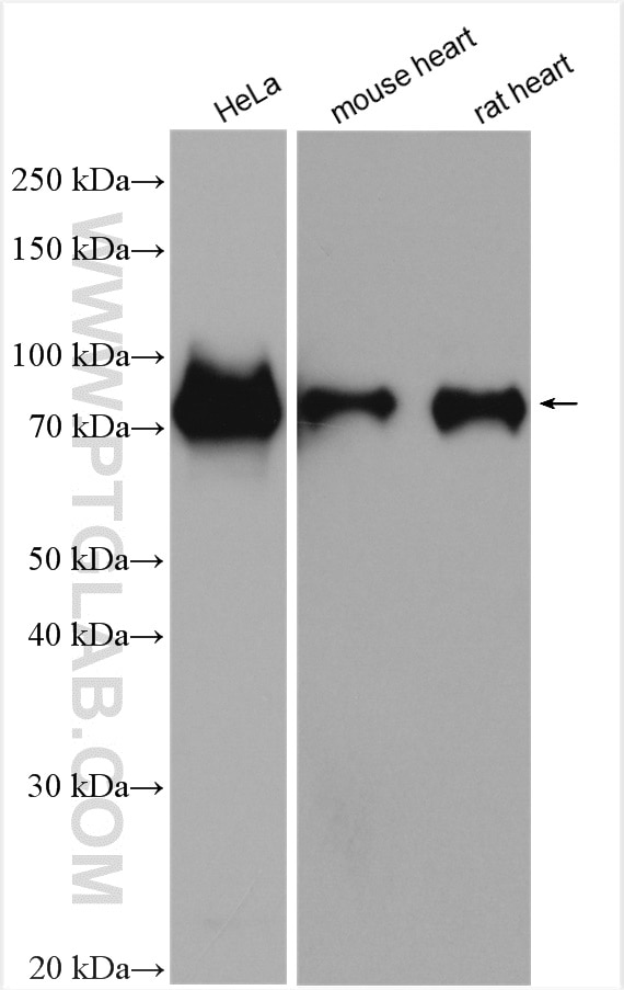 Western Blot (WB) analysis of various lysates using SNX9 Polyclonal antibody (15721-1-AP)