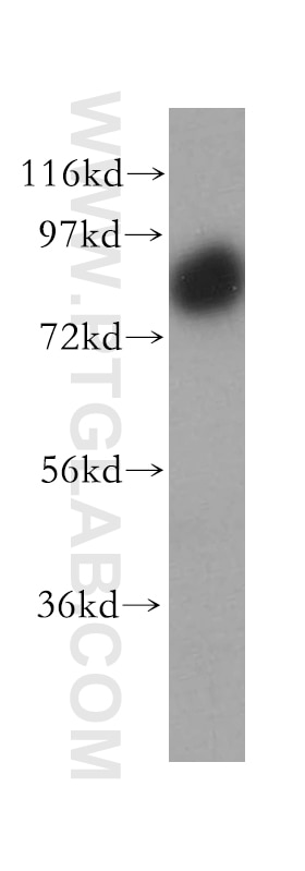 Western Blot (WB) analysis of human heart tissue using SNX9 Polyclonal antibody (15721-1-AP)