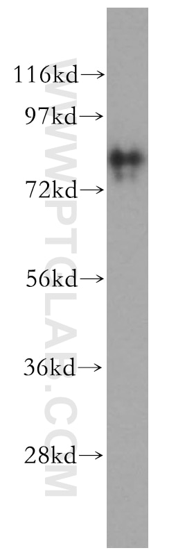 WB analysis of mouse skeletal muscle using 15721-1-AP