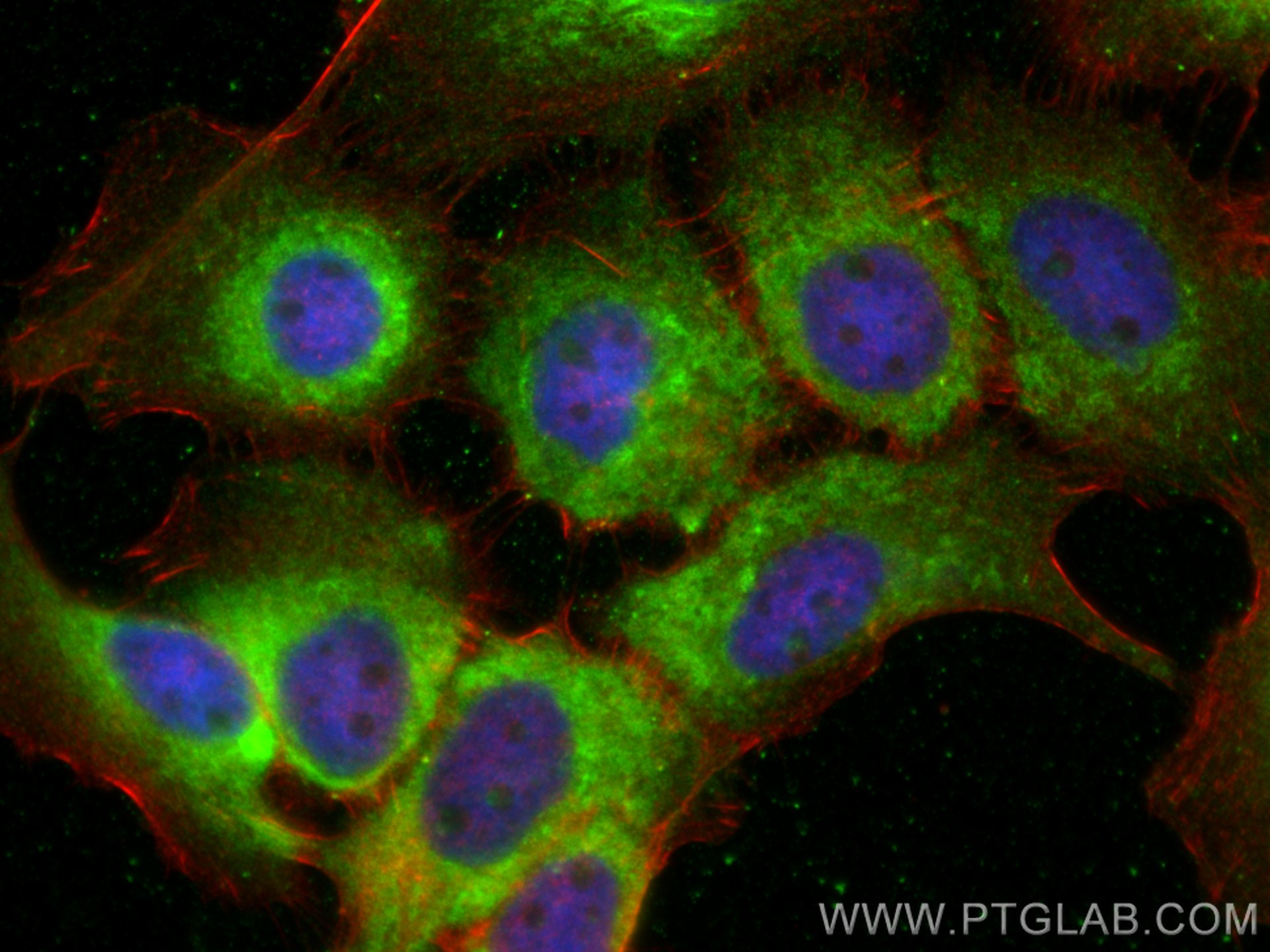 Immunofluorescence (IF) / fluorescent staining of A431 cells using SNX9 Monoclonal antibody (68255-1-Ig)
