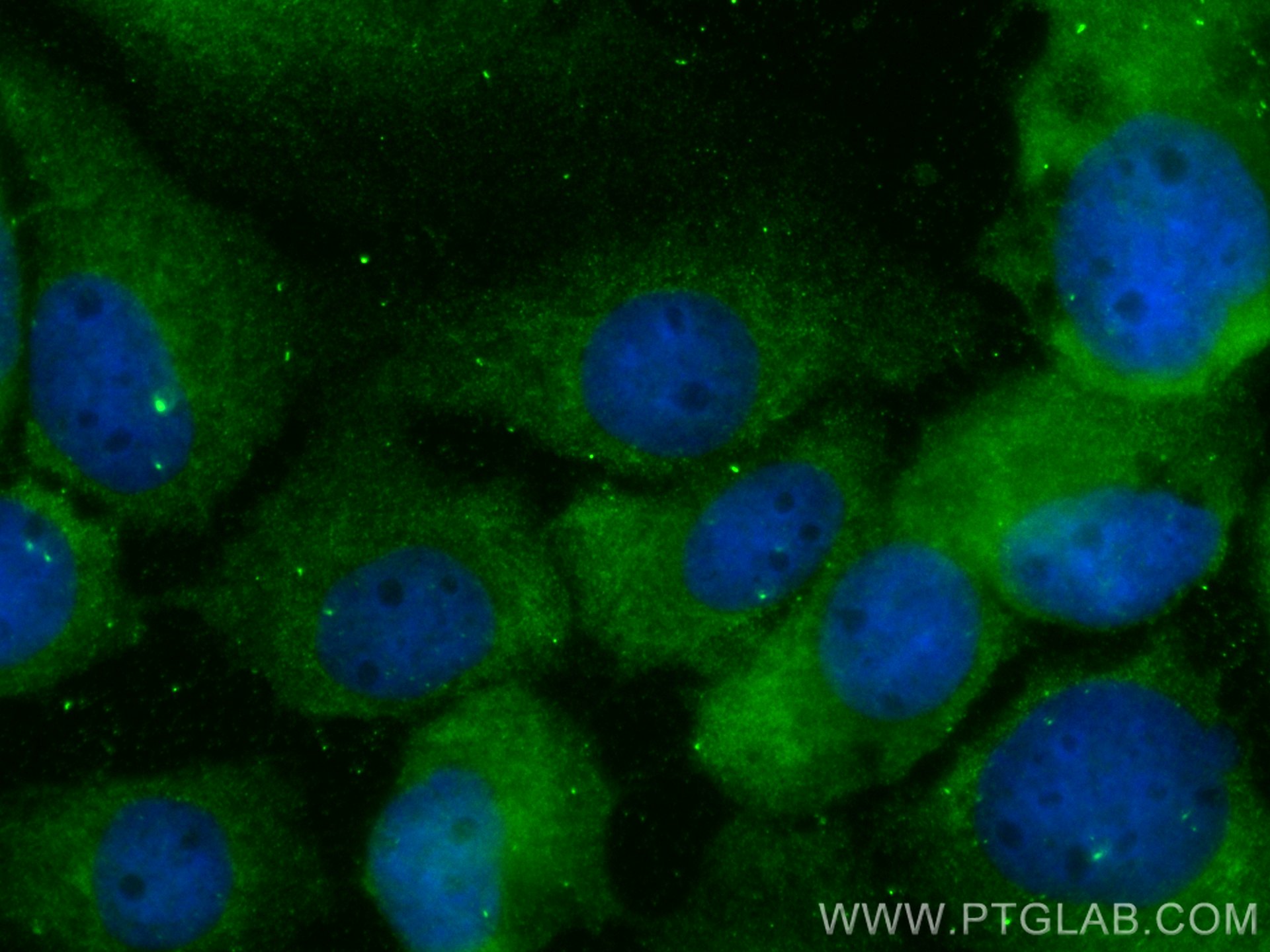 Immunofluorescence (IF) / fluorescent staining of A431 cells using CoraLite® Plus 488-conjugated SNX9 Monoclonal anti (CL488-68255)