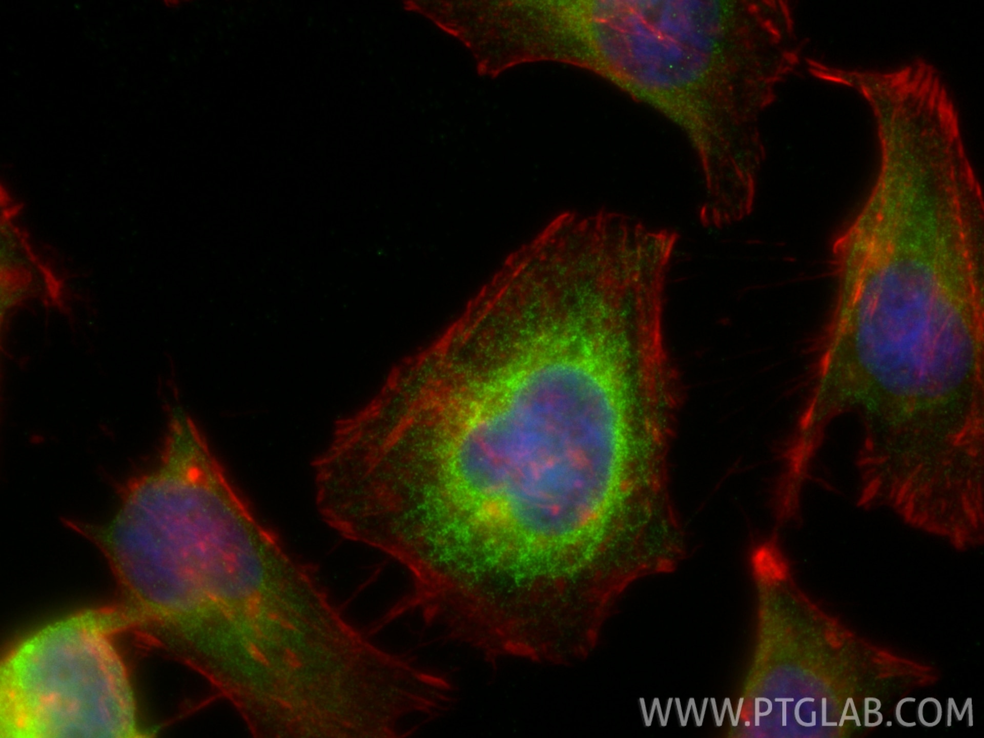 Immunofluorescence (IF) / fluorescent staining of HeLa cells using SOAT1/ACAT1 Polyclonal antibody (29369-1-AP)