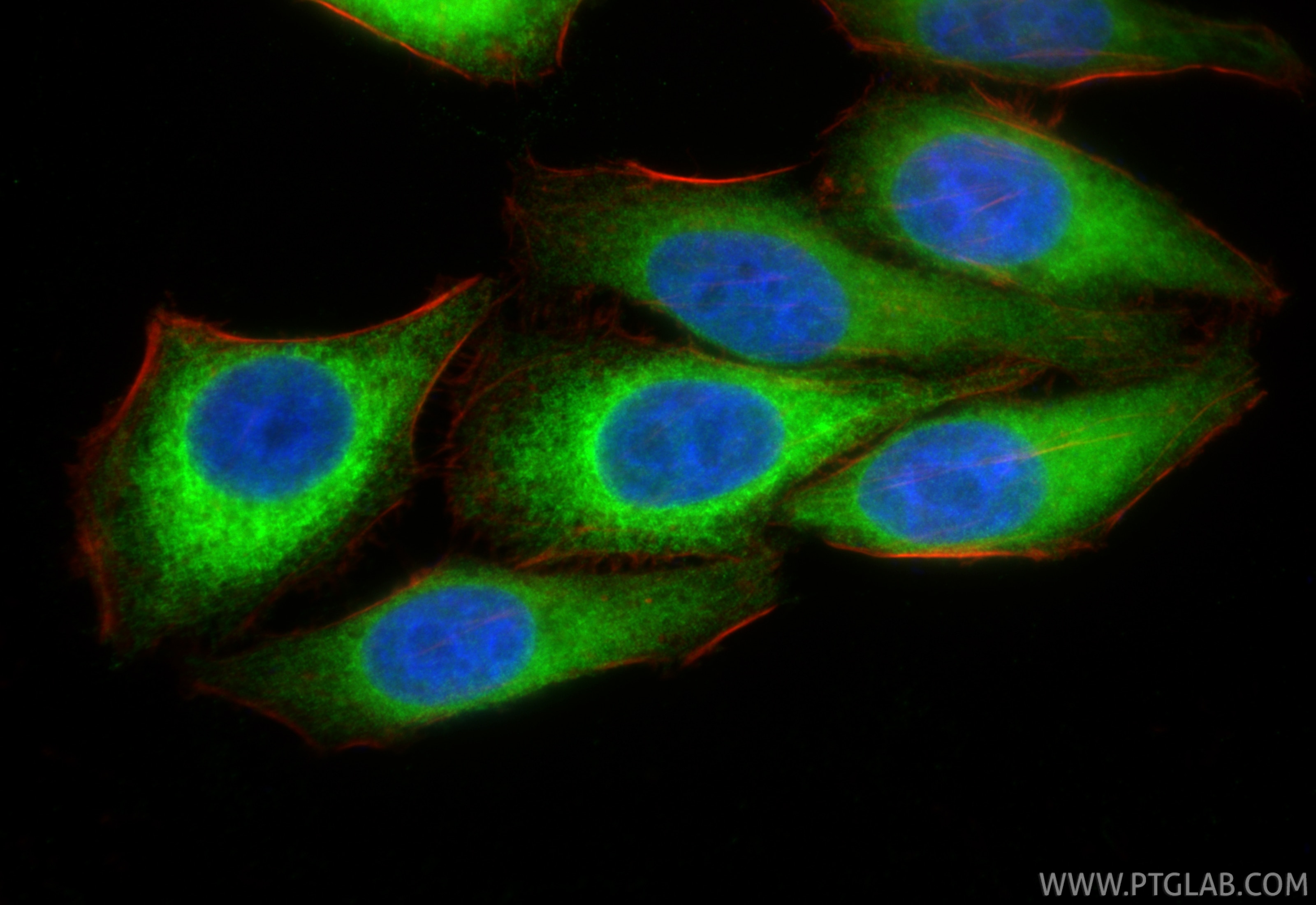 Immunofluorescence (IF) / fluorescent staining of HepG2 cells using SOAT1/ACAT1 Polyclonal antibody (29369-1-AP)