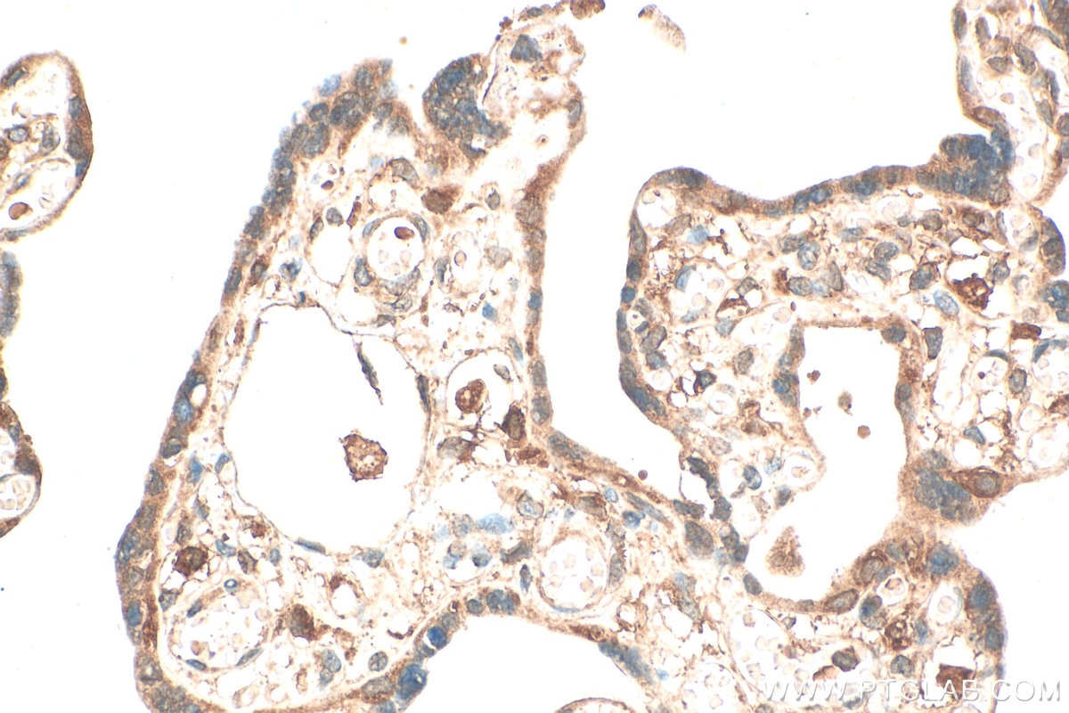 Immunohistochemistry (IHC) staining of human placenta tissue using SOAT1 Polyclonal antibody (29369-1-AP)