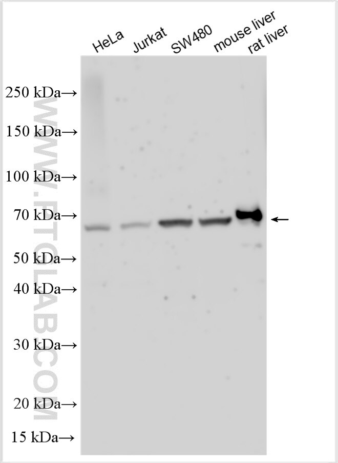 Western Blot (WB) analysis of various lysates using SOAT1 Polyclonal antibody (29369-1-AP)
