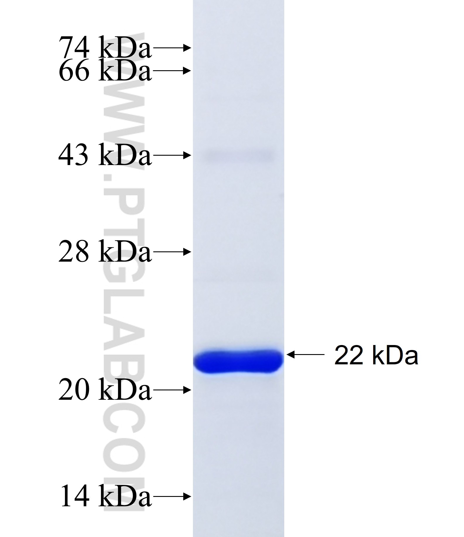SOAT1 fusion protein Ag30956 SDS-PAGE SOAT1 fusion protein Ag30956 SDS-PAGE