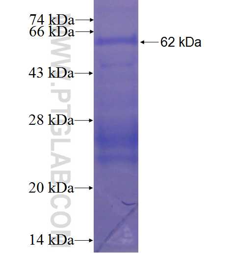 SOAT1 fusion protein Ag3944 SDS-PAGE