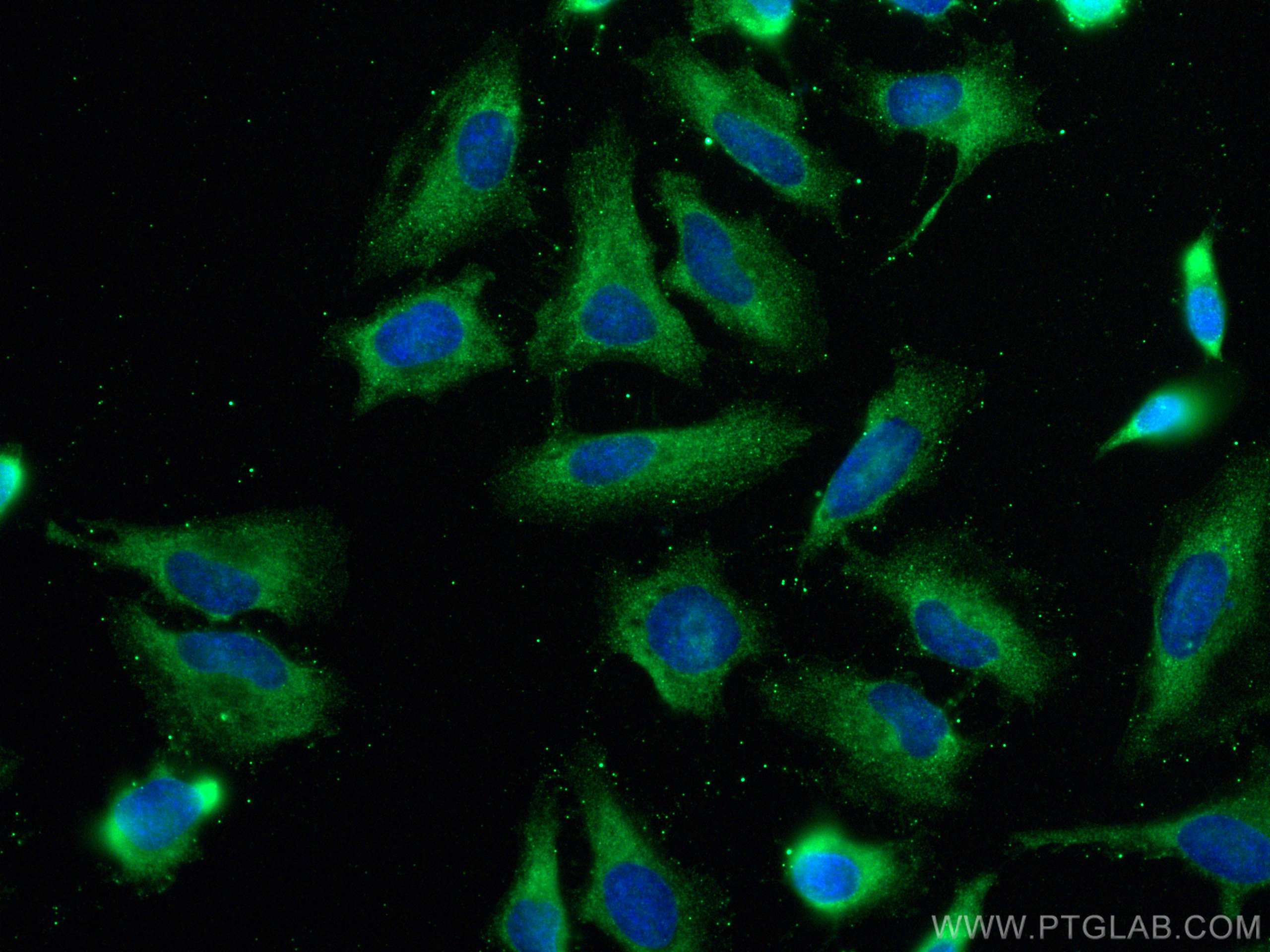 IF Staining of HeLa using 21852-1-AP