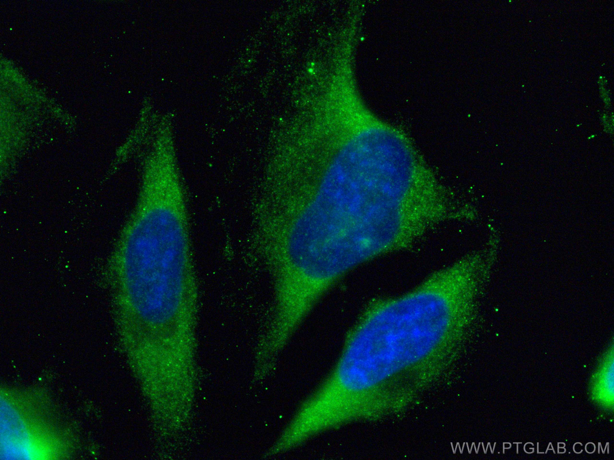 Immunofluorescence (IF) / fluorescent staining of HeLa cells using SOAT2 Polyclonal antibody (21852-1-AP)