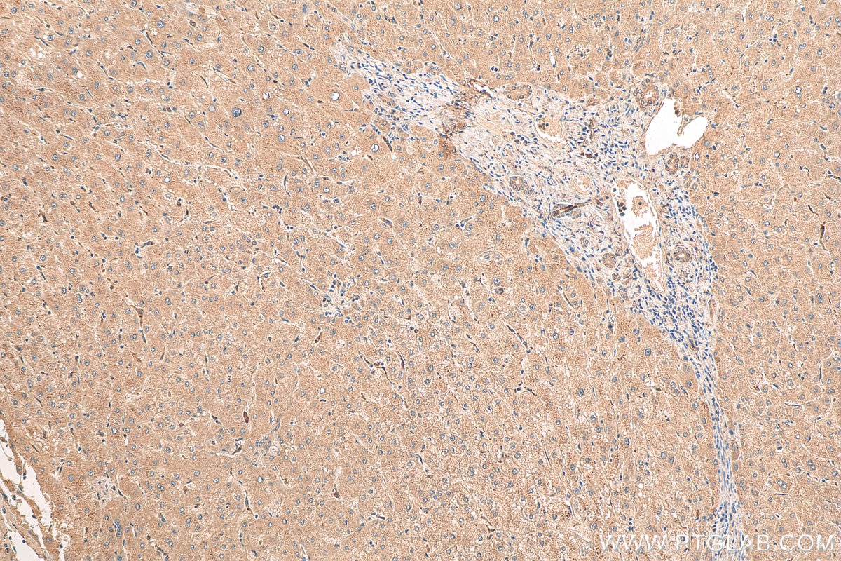 Immunohistochemistry (IHC) staining of human liver tissue using SOAT2 Polyclonal antibody (21852-1-AP)