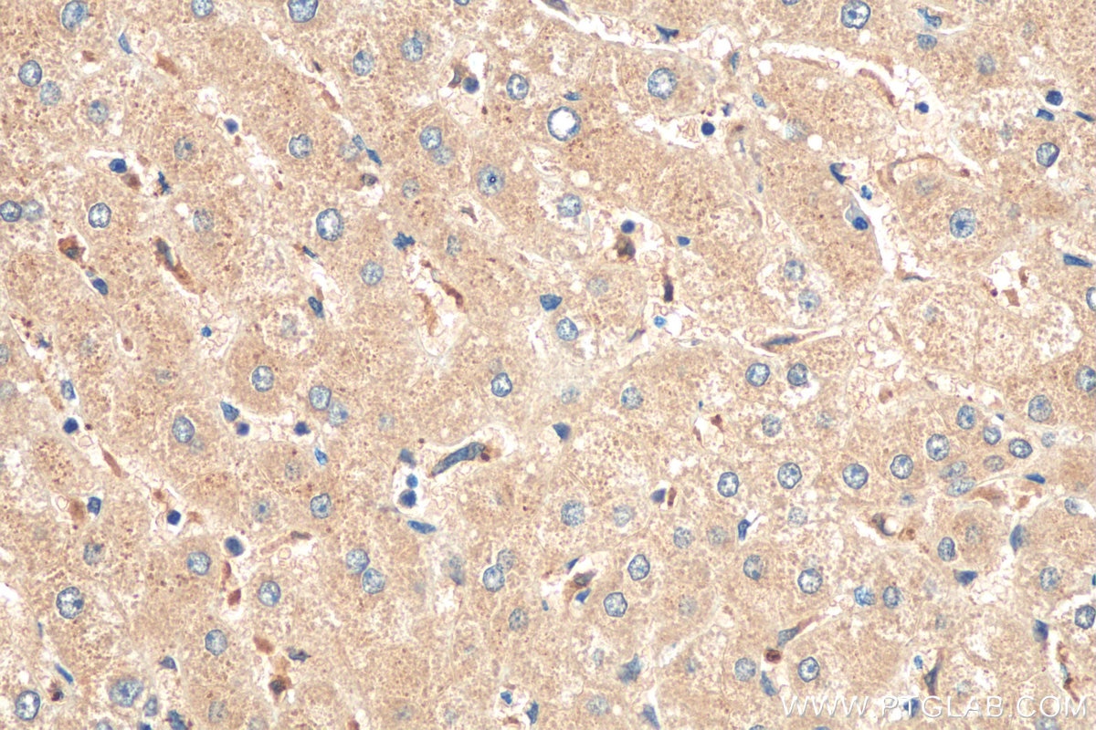 Immunohistochemistry (IHC) staining of human liver tissue using SOAT2 Polyclonal antibody (21852-1-AP)