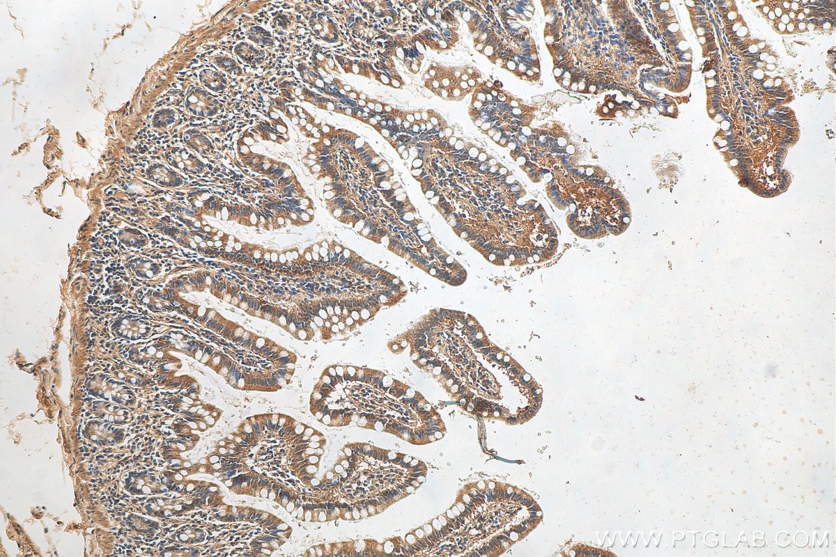 Immunohistochemistry (IHC) staining of human small intestine tissue using SOAT2 Polyclonal antibody (21852-1-AP)