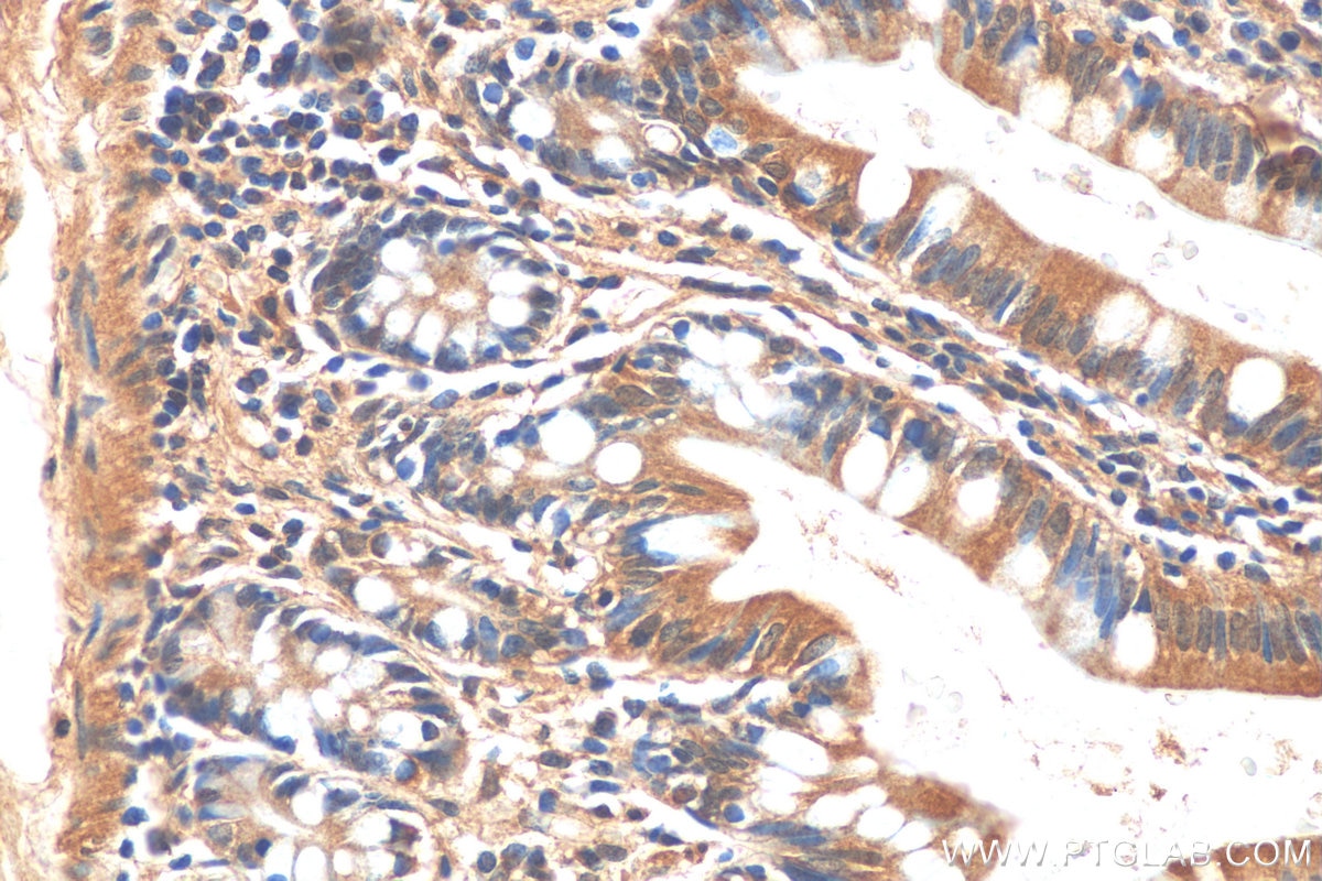 Immunohistochemistry (IHC) staining of human small intestine tissue using SOAT2 Polyclonal antibody (21852-1-AP)