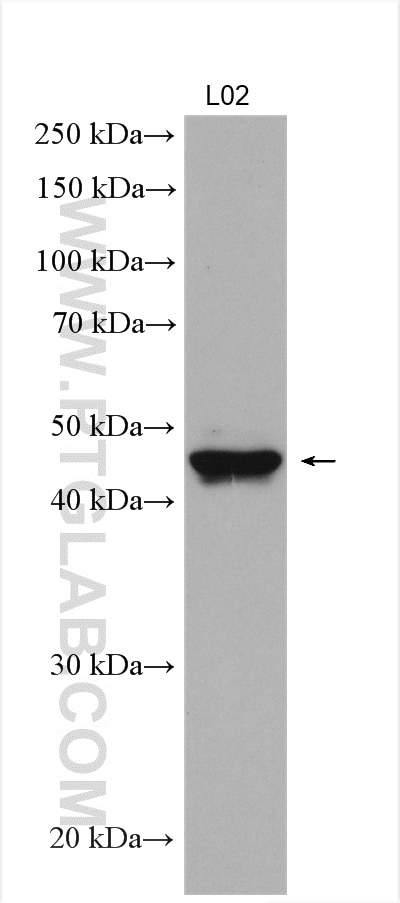 Western Blot (WB) analysis of L02 cells using SOAT2 Polyclonal antibody (21852-1-AP)