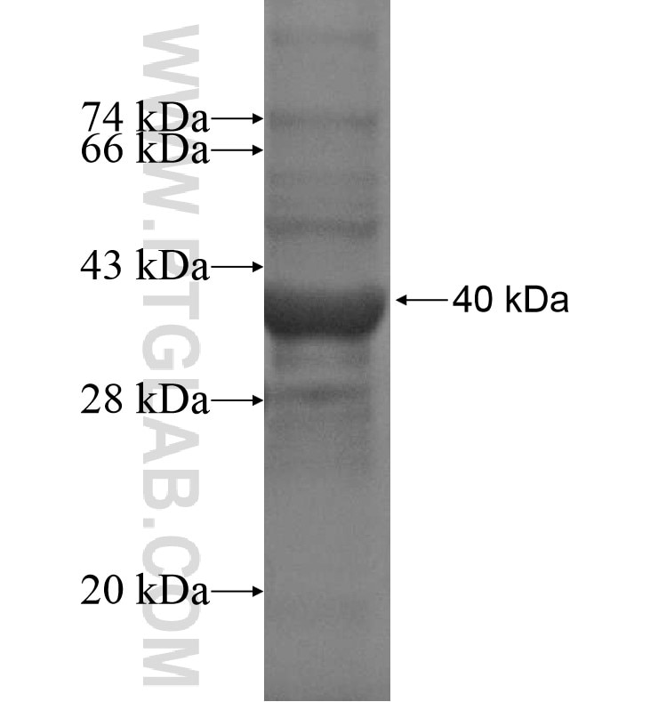 SOAT2 fusion protein Ag16364 SDS-PAGE