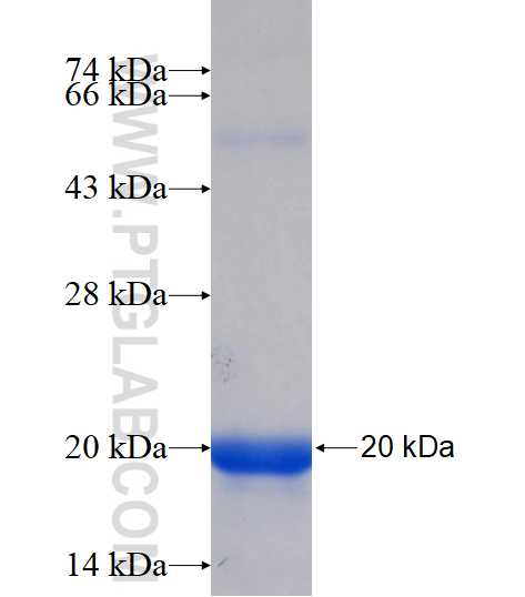 SOAT2 fusion protein Ag16757 SDS-PAGE