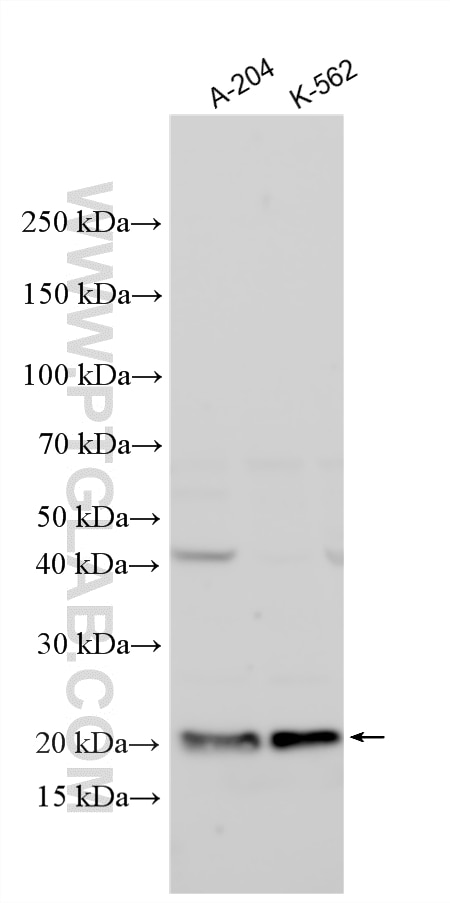 Western Blot (WB) analysis of various lysates using SOCS2 Polyclonal antibody (16038-1-AP)