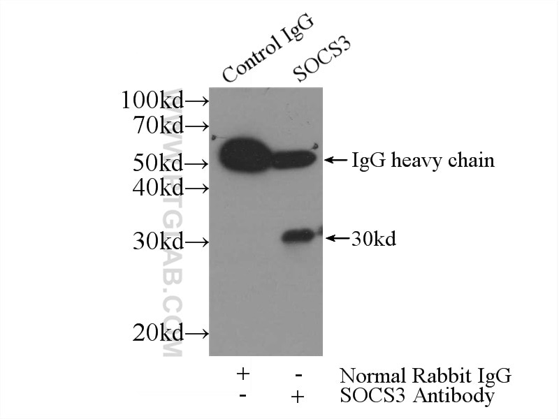 Immunoprecipitation (IP) experiment of K-562 cells using SOCS3 Polyclonal antibody (14025-1-AP)