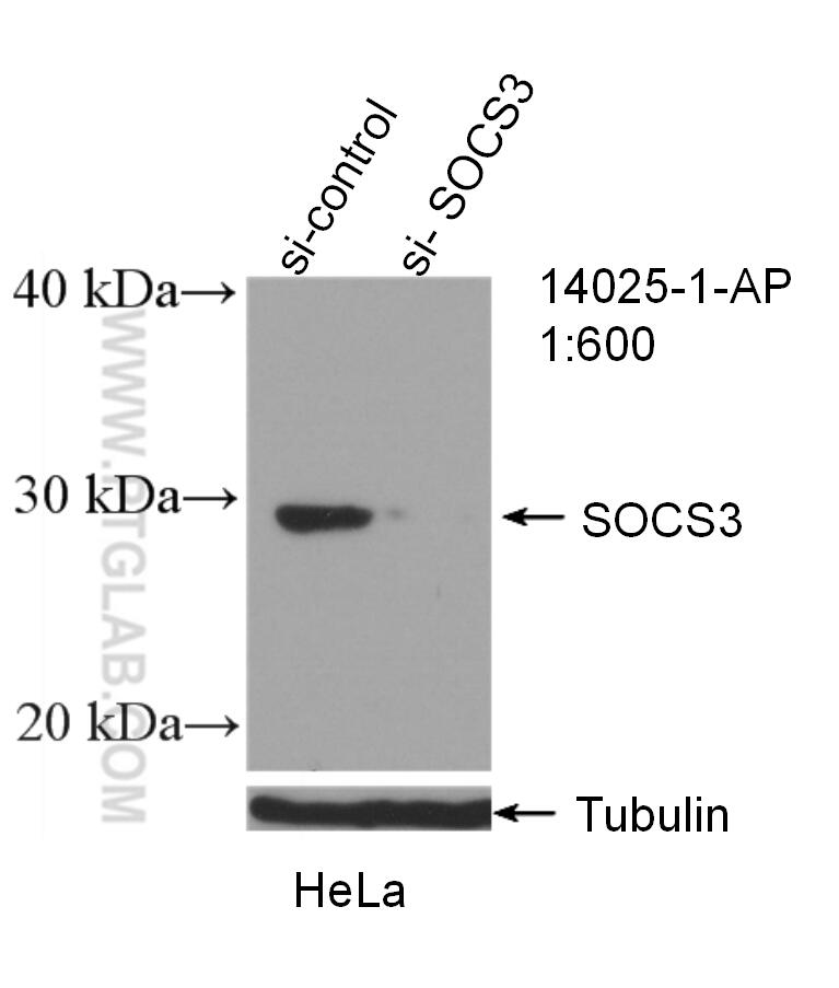 Western Blot (WB) analysis of HeLa cells using SOCS3 Polyclonal antibody (14025-1-AP)