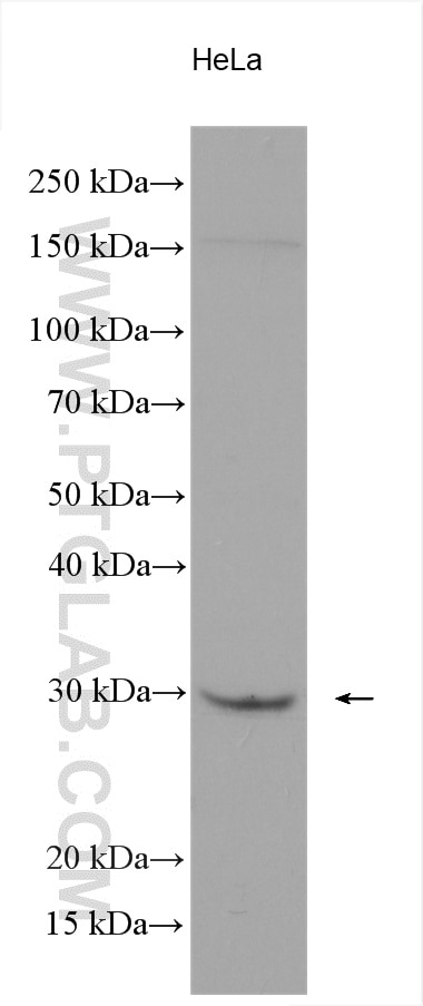 Western Blot (WB) analysis of various lysates using SOCS3 Polyclonal antibody (14025-1-AP)