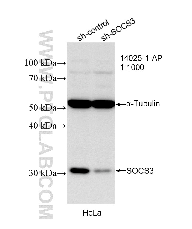 WB analysis of HeLa using 14025-1-AP Western Blot (WB) analysis of HeLa cells using SOCS3 Polyclonal antibody (14025-1-AP)