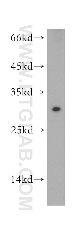 SOCS3 Polyclonal antibody